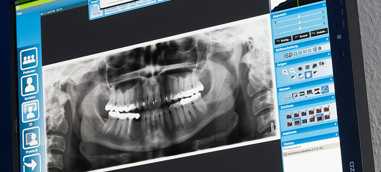 Umfassende Behandlungen beim Zahnarzt in Mönchengladbach